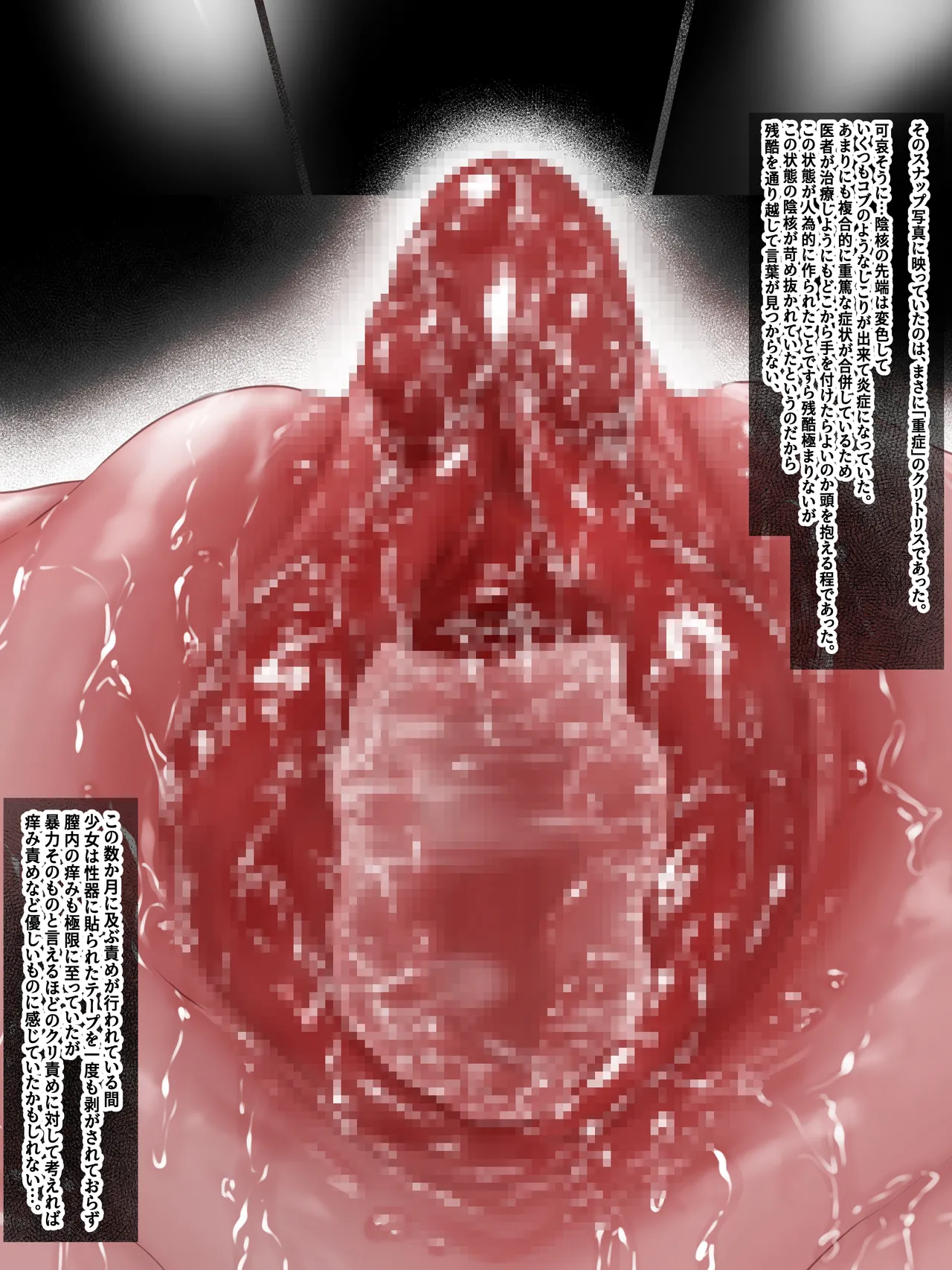 拘束少女器具責め漫画 女体器具蹂躙～完全拘束少女／クリ肥大化実験／無限ディルド機械姦／性器徹底集中責めなど～ Page.110