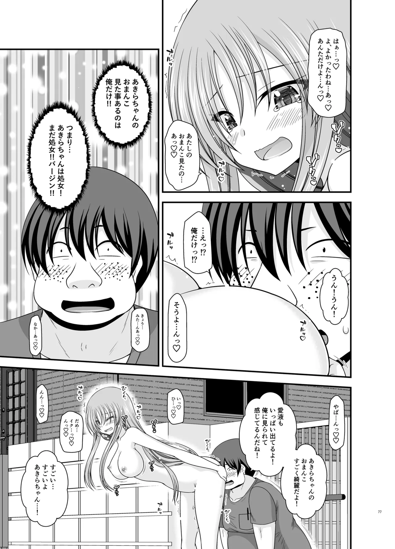 露出少女遊戯Aグレースケール版 Page.76
