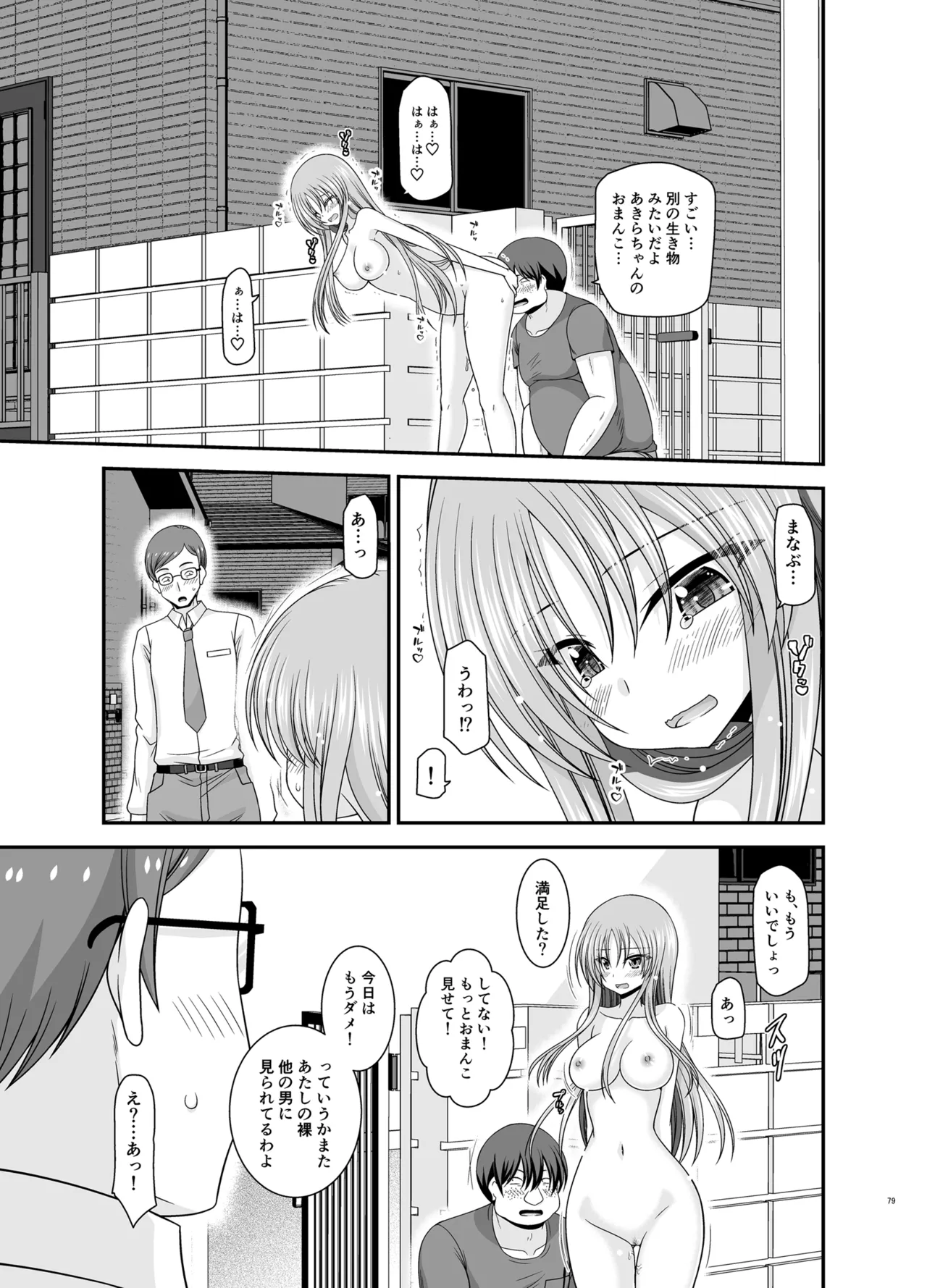 露出少女遊戯Aグレースケール版 Page.78